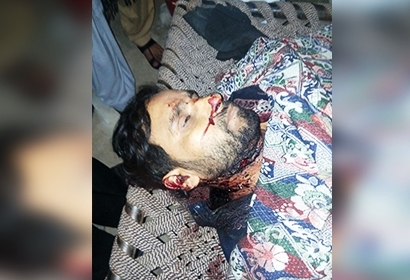 پاکستان میں دہشتگردوں کی فائرنگ سے ایک اور شیعہ شہید