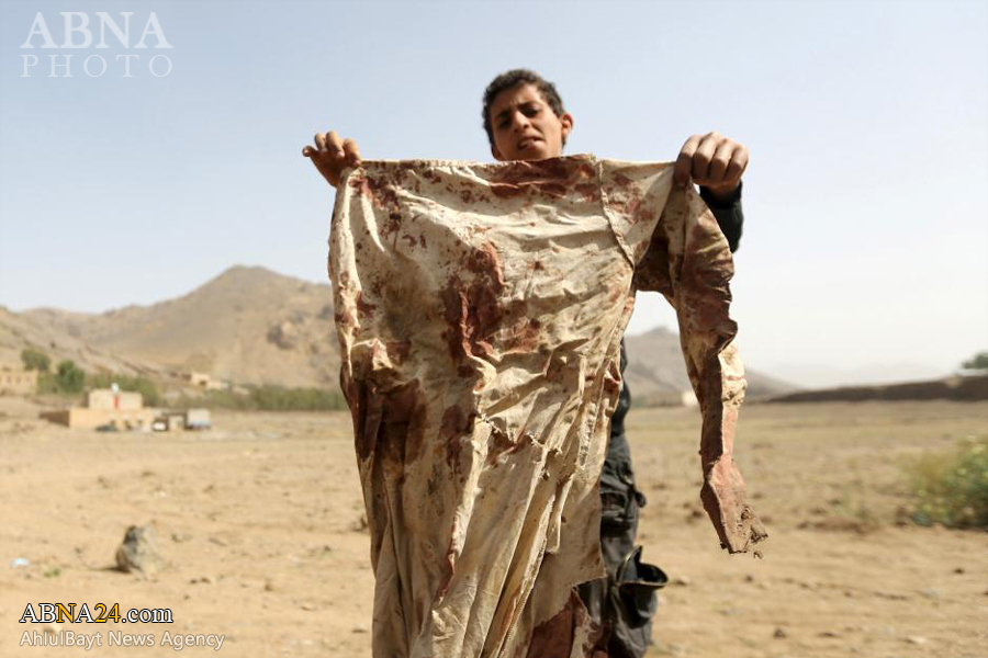 “Las Huellas de los Ataques del Régimen Saudí en Yemen”