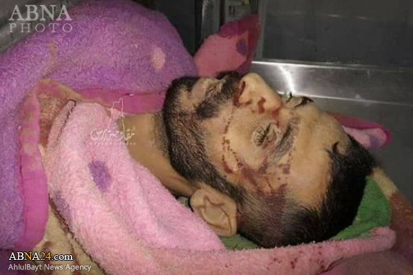 Two Palestinians killed, five injured in Israeli airstrike on southern Gaza / Pics
