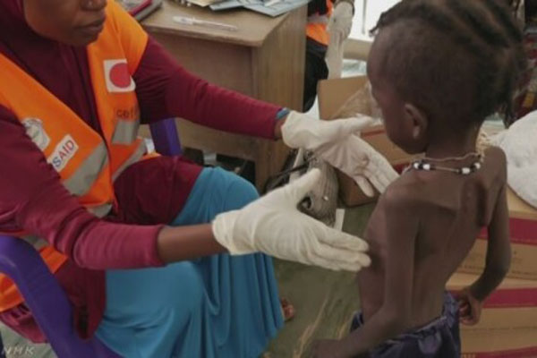 ４か国で食糧危機 「子ども１４０万人が命の危険に」