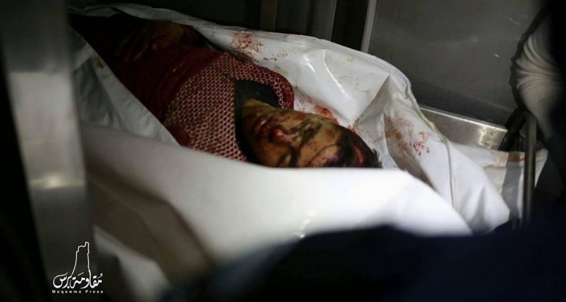 استشهاد وإصابة ثلاثة فلسطينيين في قصف مدفعي إسرائيلي شرق رفح+(صور)