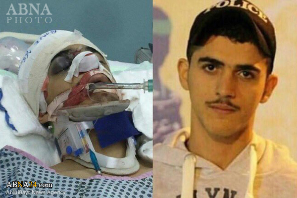 Bahraini teenager martyred by regime forces’ fire / Pics