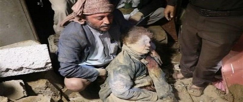 Yemen’de Katliam Var