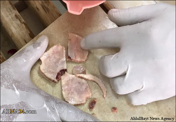 أجزاء من جمجمة الشهيد "مصطفى حمدان" المهشمة تنضم إلى جسده الطاهر + (صور)