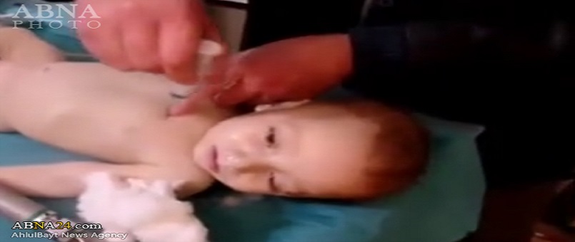 Beyaz Kasklılar Suriyeli Çocuklara ''Adrenalin'' Enjekte Ederek Öldürdü / Foto