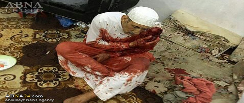 Siyonist Suudiler Arabistan’ın Şii bölgelerinde Şii katliamına başladı/ Siyonist Suudiler iki yaşındaki Şii çocuğu katletti/Foto