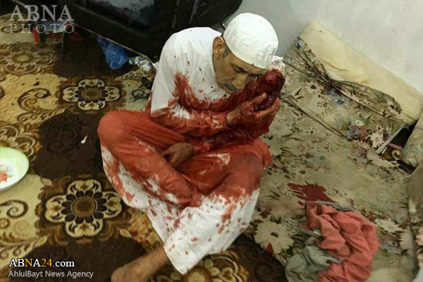 Las Fuerzas Saudíes Atacan Al-Masoura en Al-Awamiyah, Matando a 2 Musulmanes Shiítas, Hiriendo a Varios  