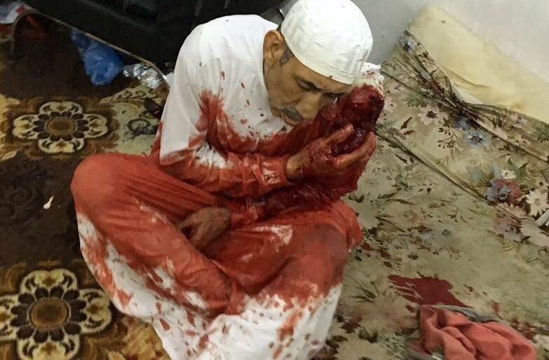 الصمت الدولي تجاه جرائم النظام السعودي شجعه للتمادي في وحشيته