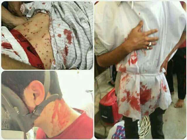 ¡Bahréin se Desangra! Régimen Bahreiní Sitia Ciudad de Diraz 