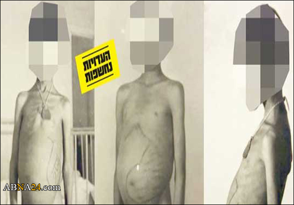 إسرائيل أجرت تجارب على أطفال يمنيين أحياء بعد هجرتهم إلى فلسطين المحتلة