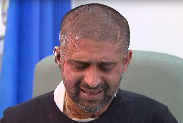 Acid attack on Biritish Muslim cousins being treated as hate crime