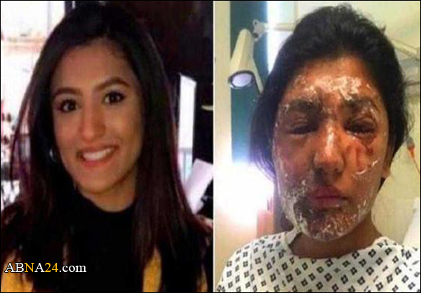 المتهم بحرق وجه "مسلمة" في لندن يسلم نفسه للشرطة