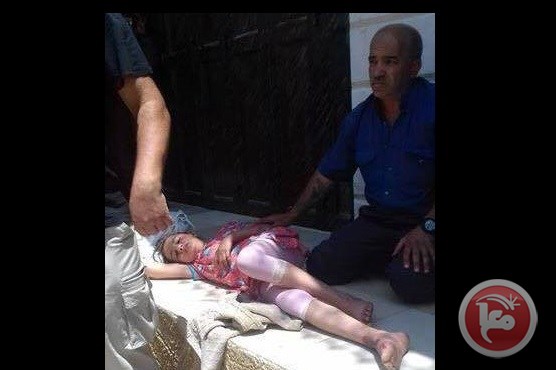 Palestinian child seriously injured after being struck by Israeli settler vehicle