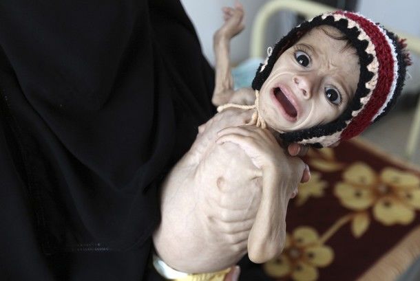 New record of world famine in Yemen
