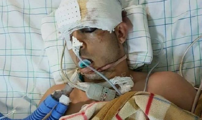 وفاة ناشط مغربي متأثرا بإصابته في احتجاجات الحسيمة