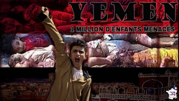 Un million d’enfants menacés par le choléra au Yémen !
