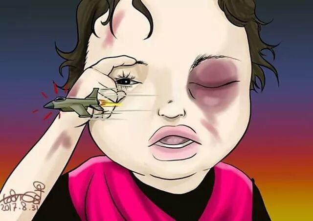 La Pequeña Buthaina; Símbolo de la Barbarie Saudí en Yemen