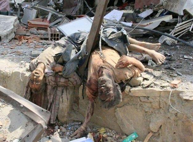 العفو الدولية تكشف جرائم تحالف السعودية للعدوان علی اليمن