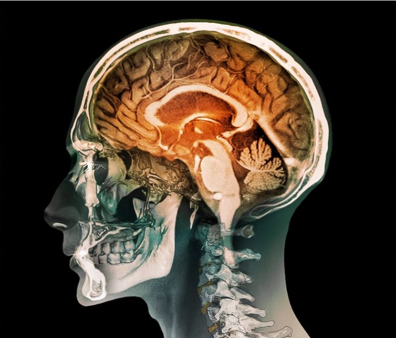Descubren que la Mente Humana Sigue Funcionando Después de la Muerte Clínica del Cuerpo 