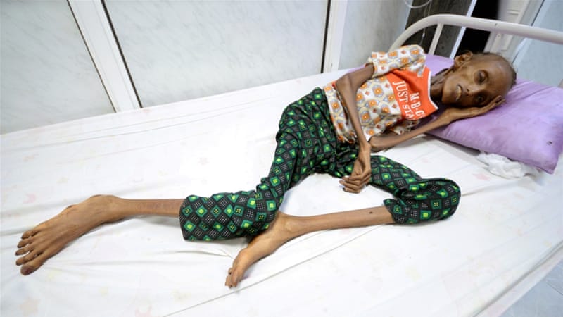 Millions of Yemenis will die of famine if Saudi-led coalition blockade not lifted: UN