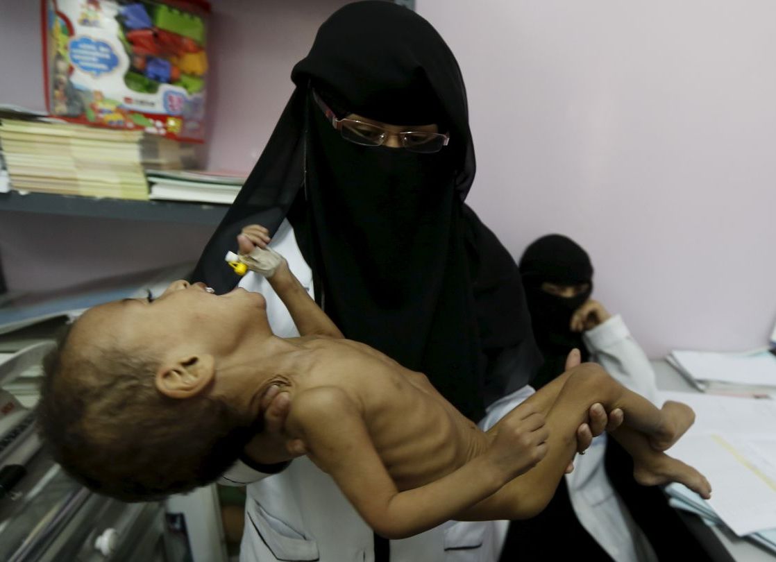 الأمم المتحدة تطالب برفع كامل للحصار عن اليمن