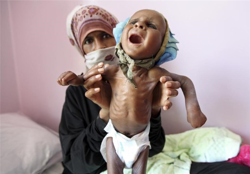 11 مليون طفل في اليمن بحاجة للمساعدة والإمدادات التي وصلت غير كافية