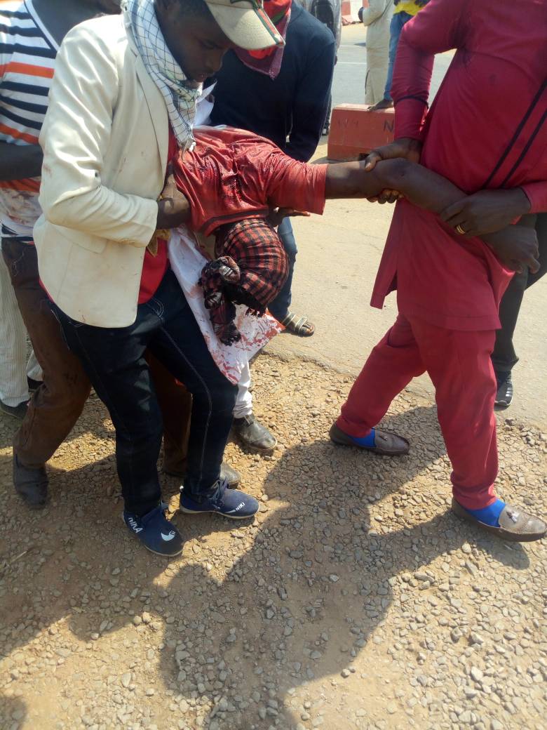 Nigeria in sea of blood: Buhari regime fire teargas and live bullets on peaceful free Zakzaky protesters in Abuja / Graphic (2)
