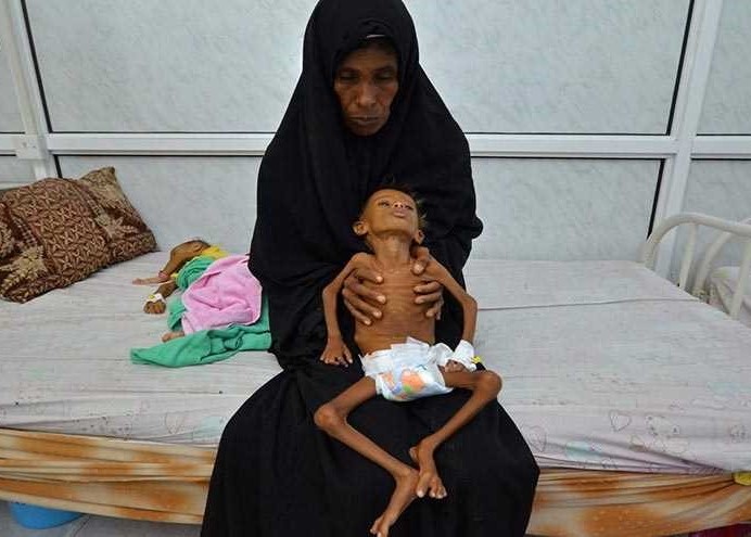الامم المتحدة: أكثر من 22 مليون يمني بحاجة الى مساعدات