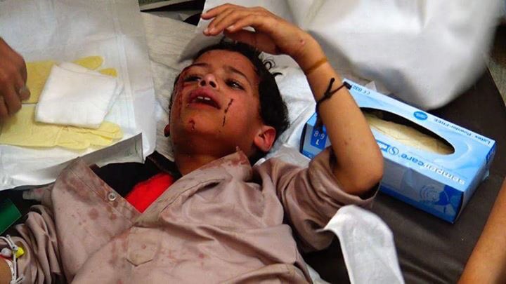 Over 5,000 children killed, injured in Saudi aggression on Yemen: UN