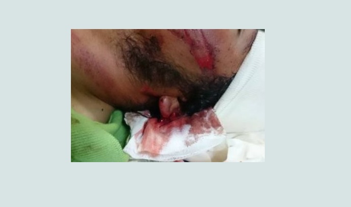 Israeli colonizers invade home, injure woman and her son
