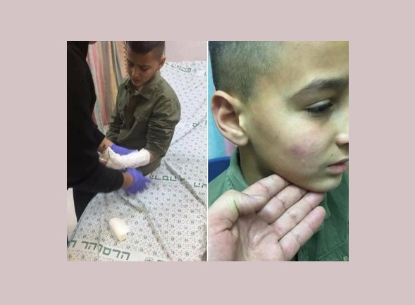 Israeli army abducts three Palestinians, injure a child in Al-Quds