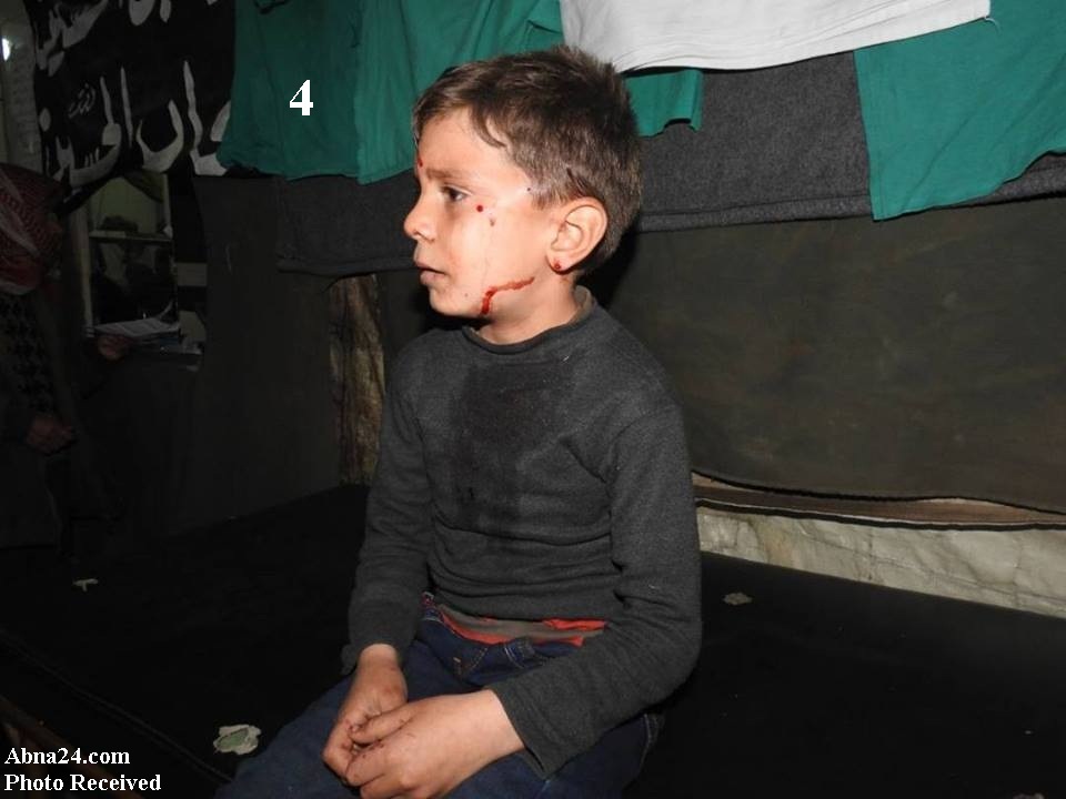 “Atentado Terrorista en Siria Hiere Gravemente a Decenas de Musulmanes Shiítas”