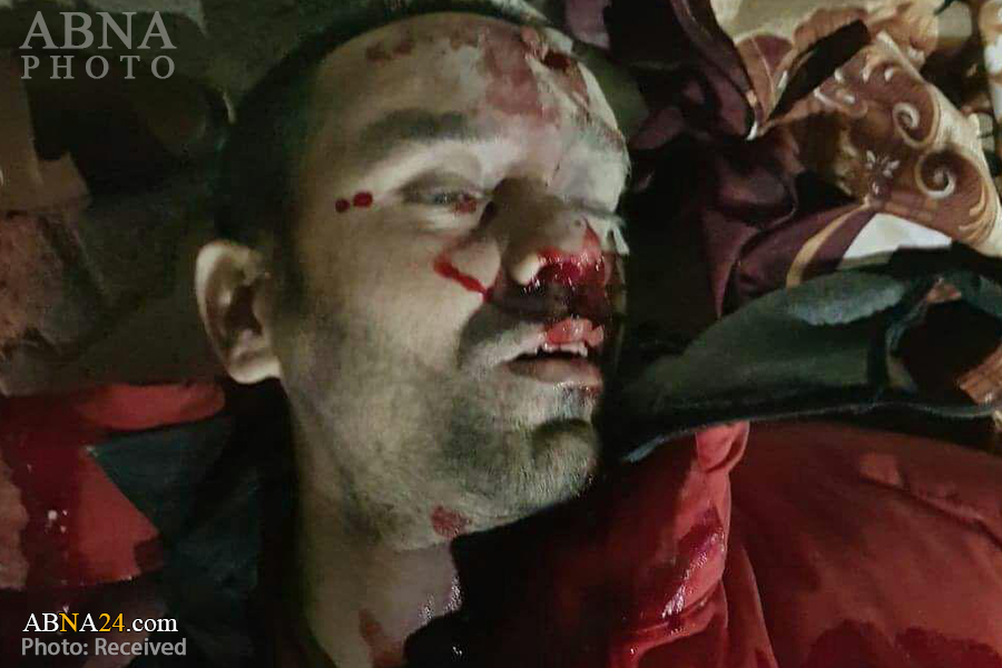 کوئٹہ، موٹرسائیکل سواروں کی فائرنگ ، ٹریفک پولیس اہلکار "مبشر عباس"  شہید + تصویر