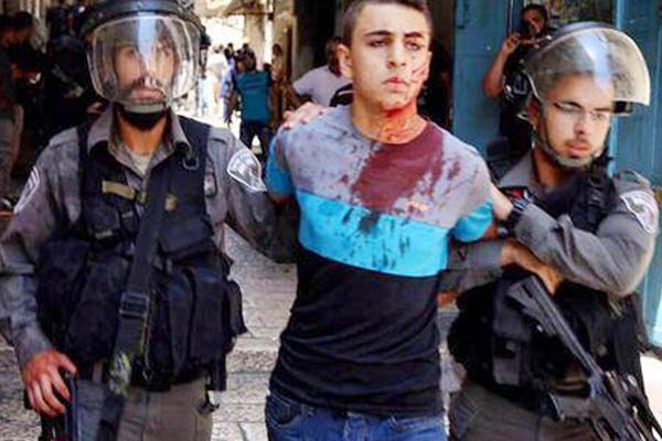 ヨルダン川西岸で、イスラエル軍の攻撃によりパレスチナ人数十人が負傷