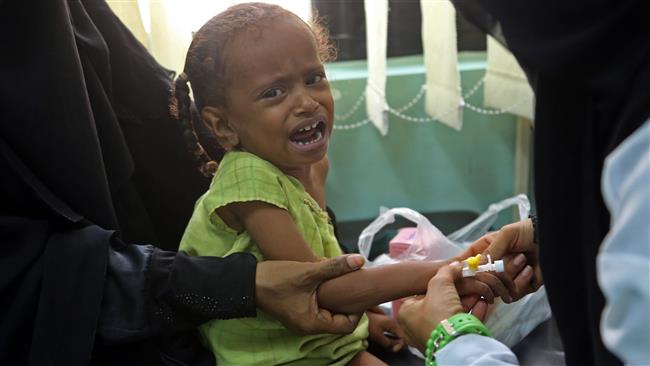 Diphtheria outbreak kills 73 in Yemen: WHO