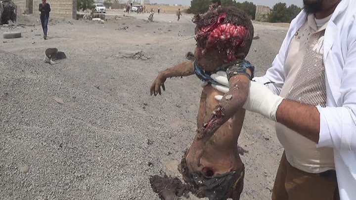 جريمة وحشية جديدة لـ آل سعود في مخيم للنازحين بالحديدة اليمنية (صور)