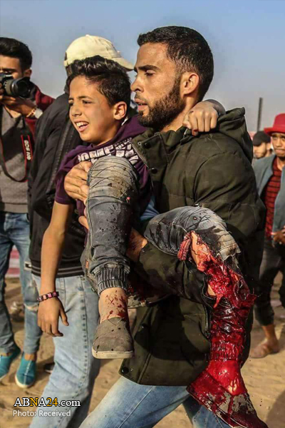 Zionistisches Verbrechen gegen  das 11-jährige Kind in Gaza + Bilder