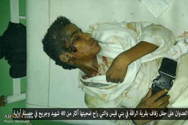 تقرير مصور/ طيران العدوان السعودي يستهدف حفل عرس في حجة باليمن