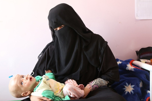 国連が、イエメンでの妊婦の痛ましい状況に懸念を表明