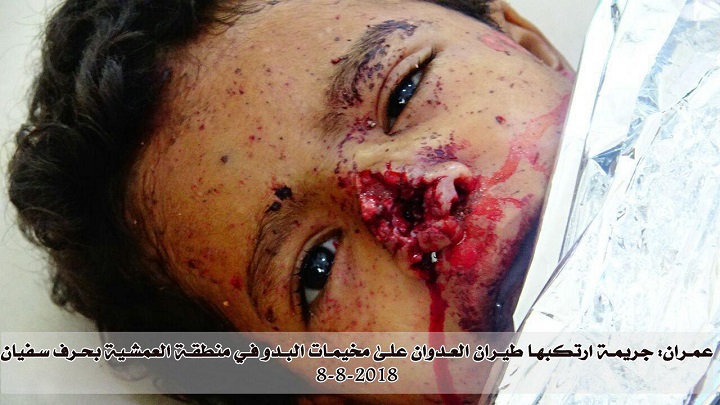 جريمة جديدة بشعة للعدوان السعودي في محافظة عمران+(صور)