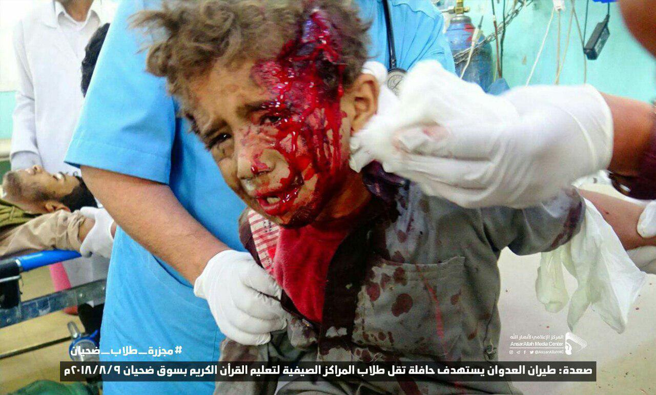 Saudi airsrike on civilian bus in Yemen kills 39 people, mostly children / Video & Graphics