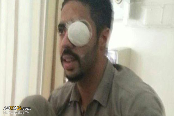 Injured Bahraini detainee denied treatment