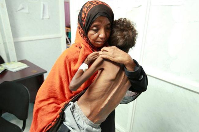 Alertan de que Yemen se quedará desabastecido de alimentos dentro de 2 o 3 meses debido al asedio y ataques saudíes