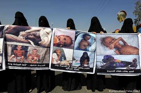 Yemen'de 400 Bin Çocuk, Aç!