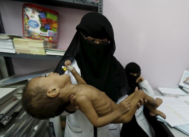 ملايين الاطفال في اليمن سيصبحون بلا غذاء