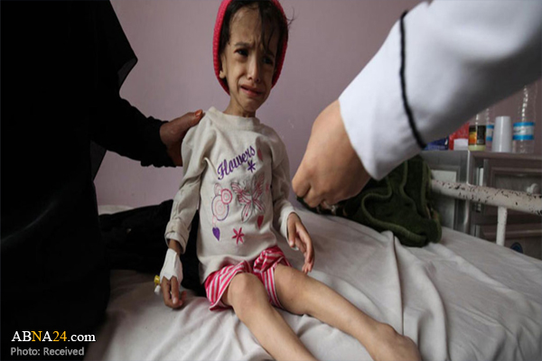 8.4 million Yemenis need urgent aid: UN