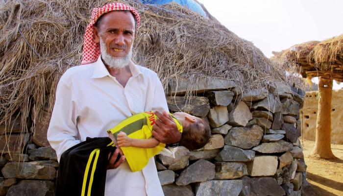 الأمم المتحدة تحذر من موت طفل يمني في كل عشر دقائق 