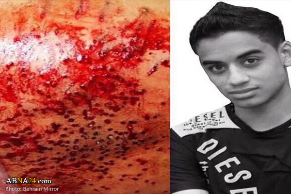 Bahraini detainee slowly dying in Jaw Prison, shrapnel in his kidney, broken teeth