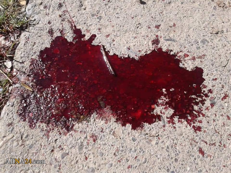 تقرير مصور/ هجوم ارهابي على سوق للشيعة المسلمين في باكستان