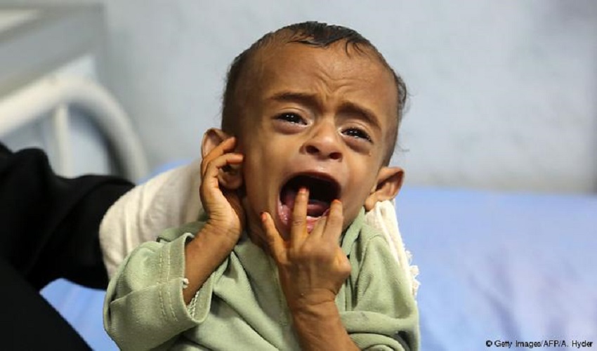 Jemen droht Hungerkatastrophe